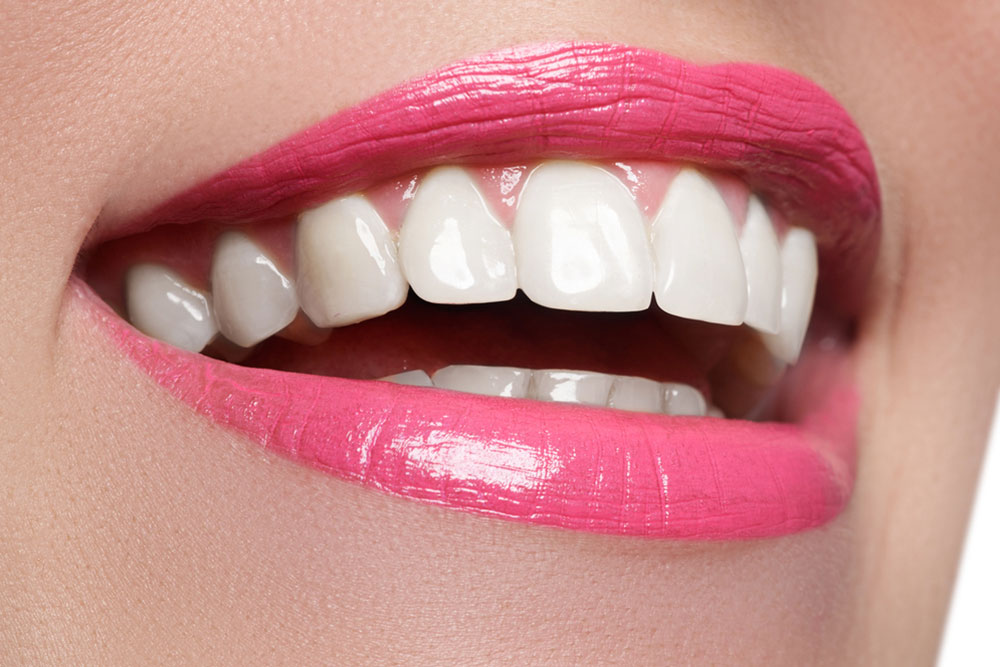 The Importance Of Teeth Whitening Before Your Wedding For A Radiant Smile