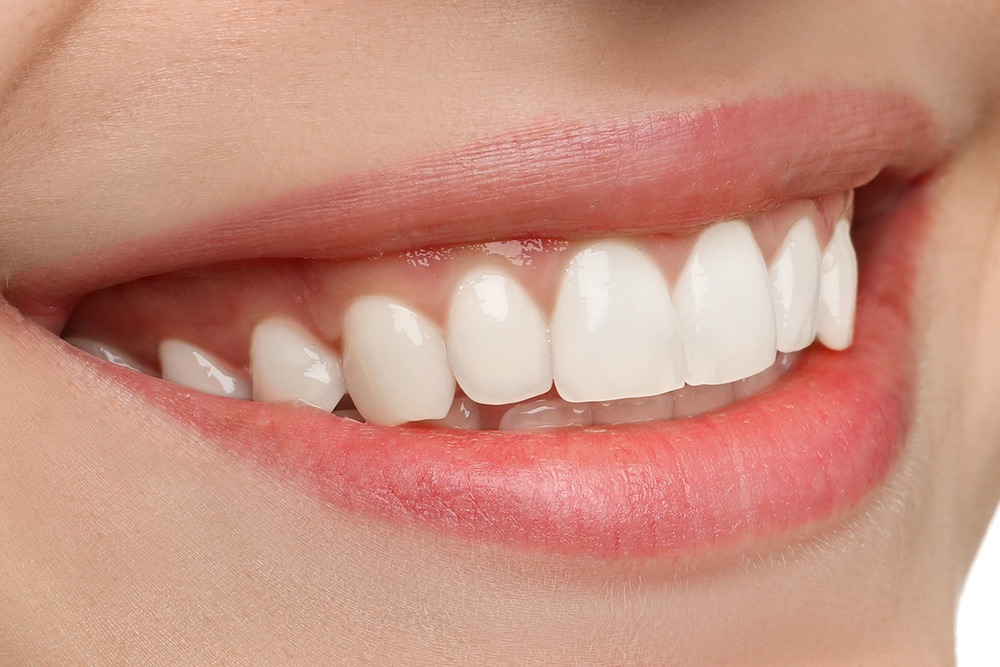 Affordable Dental Care In Baton Rouge: Your Path To A Healthier Smile